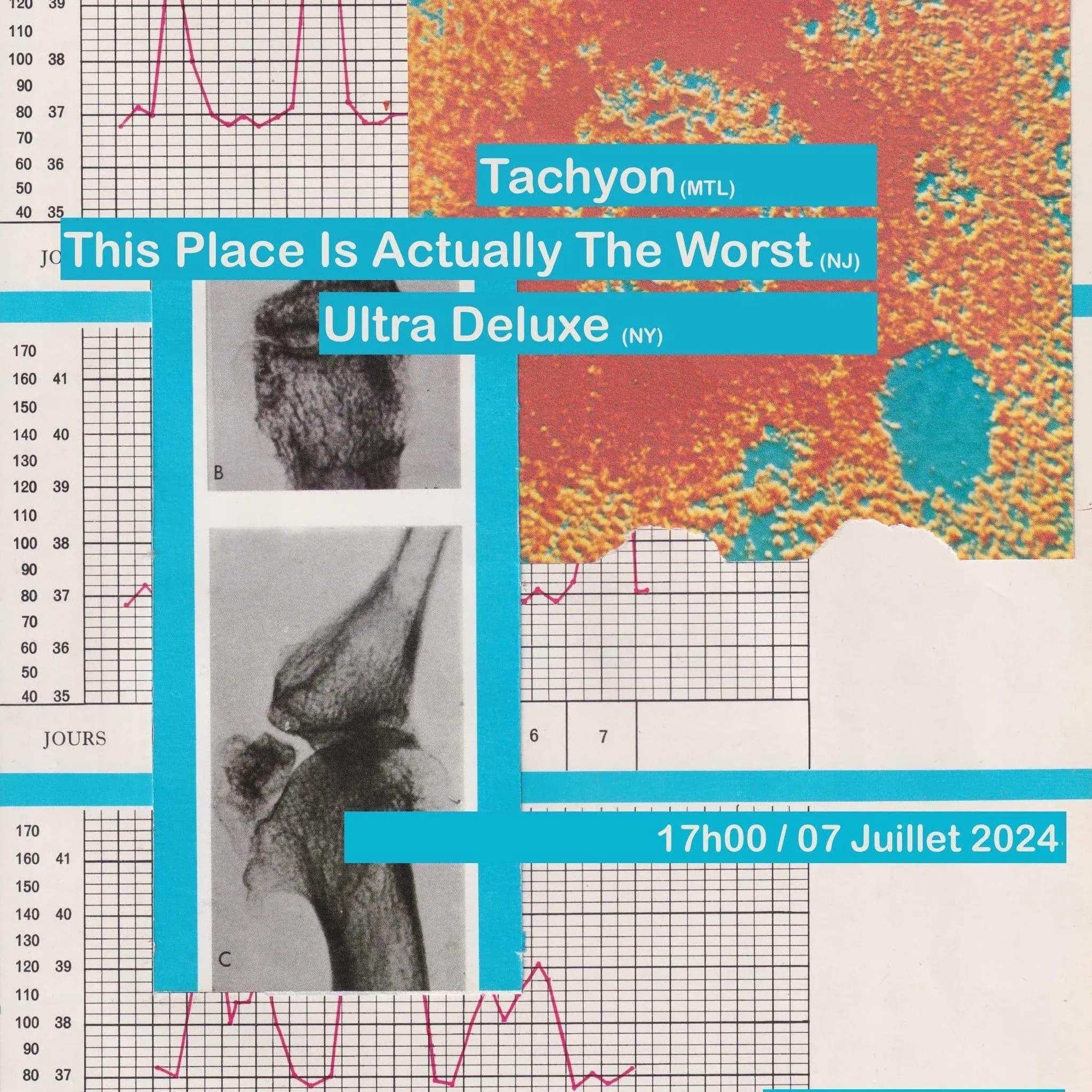 Tachyon + This Place Is Actually The Worst + Ultra Deluxe